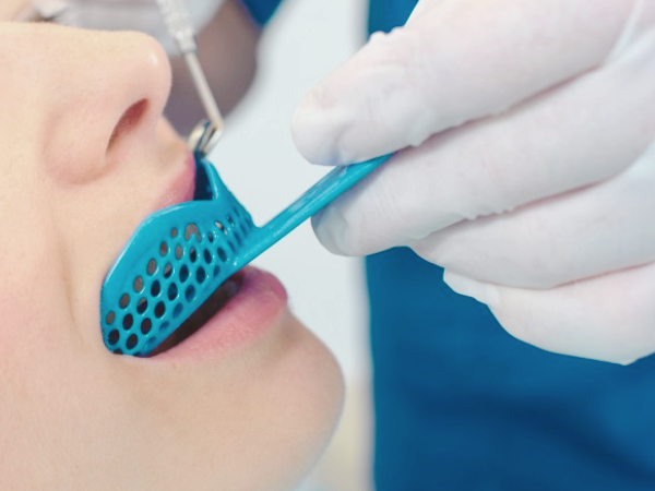 마곡동치과_ &ldquo;치아본 제대로 뜨려면?&rdquo; [4. 인상채득 시 주의할 점] 관련 이미지 2