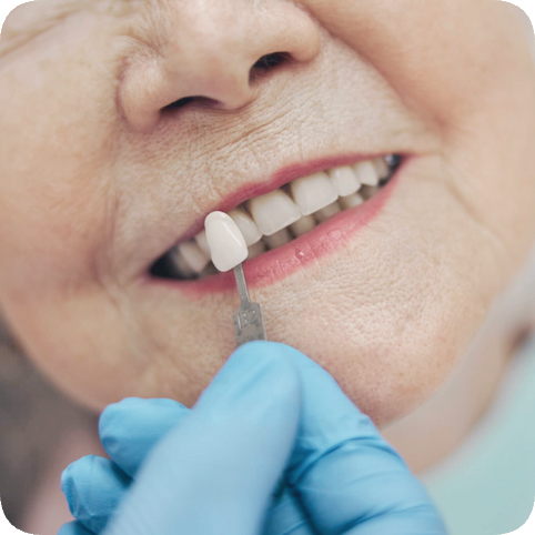 마곡역치과_ 하얀 이가 누렇게 변했다? [ 1. 치아변색의 원인 ] 관련 이미지 5