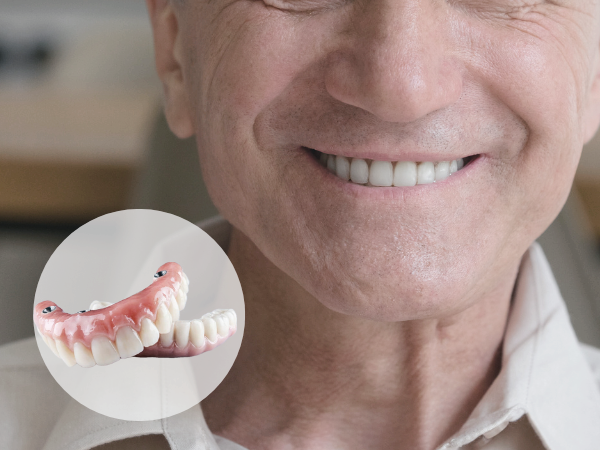 마곡동치과_ &ldquo;내 입에 딱! 맞는 선택은?&rdquo; [ 5. 임플란트 틀니 종류와 특징 ] 관련 이미지 5