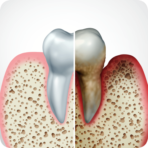 마곡동치과_3. 치주질환 자가진단 체크! 내 잇몸은 안전할까? 관련 이미지 1