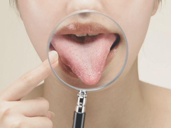 마곡역치과_&ldquo;불소도 다 똑같지 않아요!&rdquo;[2. 불소 종류와 상황별 선택법] 관련 이미지 10