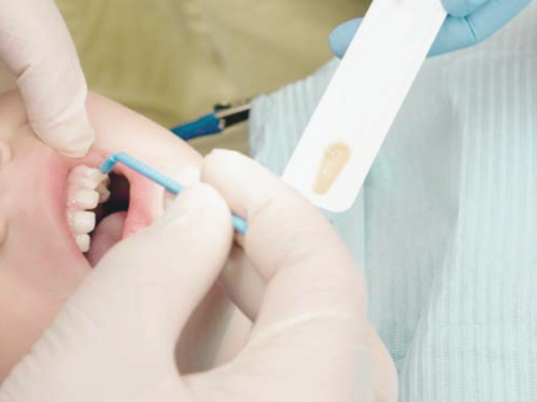 마곡역치과_2. 유치기 어린이(4~7세) 충치 예방, 부모가 꼭 알아야 할 구강 관리법 관련 이미지 7