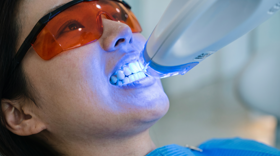 [ Magok Teeth Whitening_05 ] How Long Do the Effects of Teeth Whitening Last? image 1
