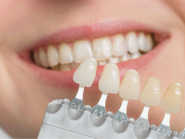 마곡치과_" 짧은 시간, 확실한 톤업" [2. 생활치 전문가 미백치료 특징과 과정 관련 이미지 2