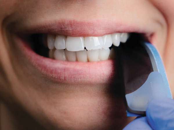 마곡역치과_6. 인레이 치료 후 보철 오래 쓰는 관리법 [ 주의사항과 수명 늘리는 습관 ] 관련 이미지 3