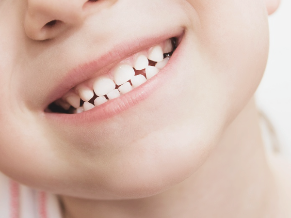 마곡역치과_2. 유치기 어린이(4~7세) 충치 예방, 부모가 꼭 알아야 할 구강 관리법 관련 이미지 1