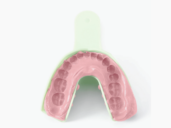 마곡동치과_ &ldquo;치아본만 잘 떠도 반은 성공!&rdquo; [3. 인상채득 진행 과정] 관련 이미지 5
