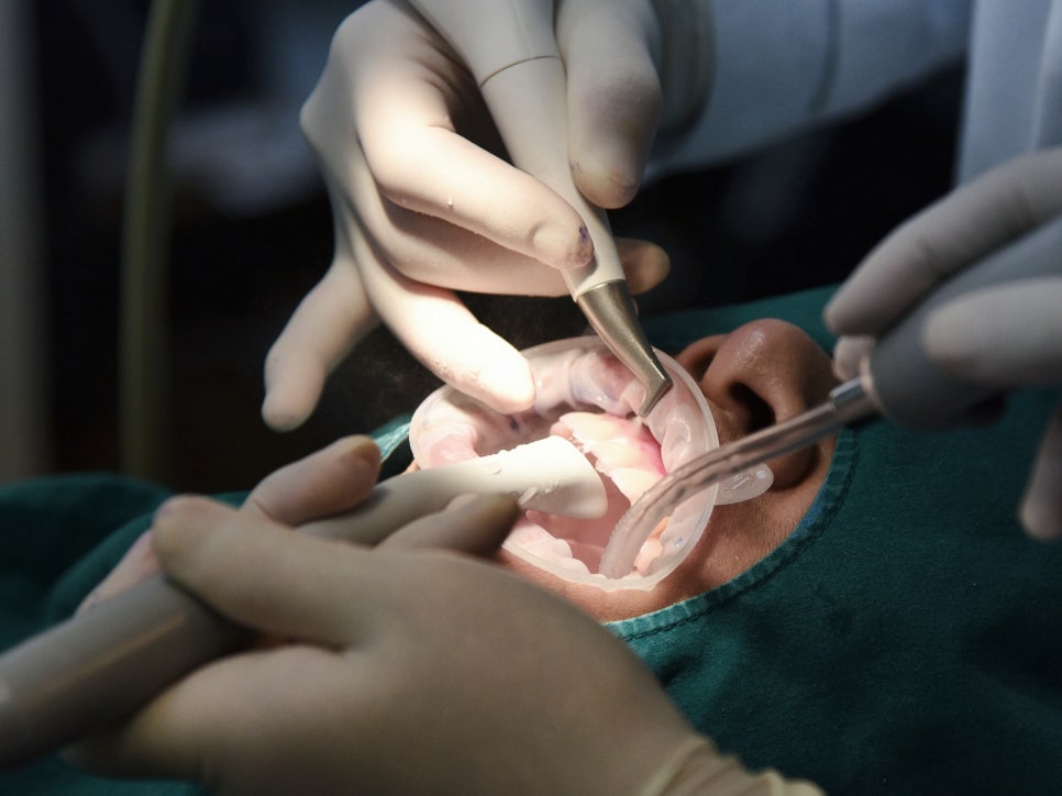 마곡치과_"통증은 줄이고, 상쾌함은 더하다!" [ 1. 에어플로우 스케일링의 원리와 특징 ] 관련 이미지 4