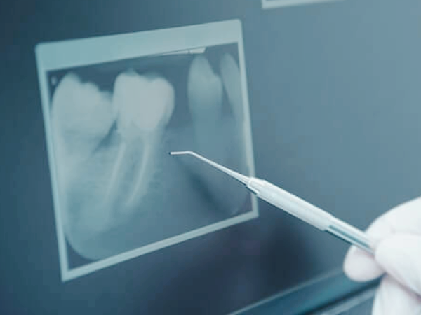 Magok-dong Dental Clinic_2. Why Are There So Many Types of Dental X-ray Radiation? A Clear Summary image 2