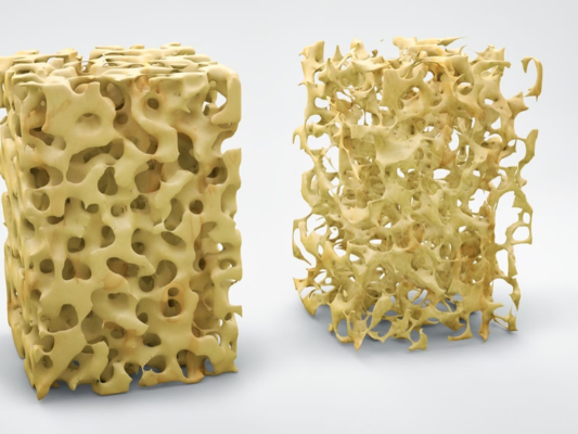 마곡치과_2. 임플란트 수술 전 전신질환별 주의 체크 포인트 관련 이미지 4