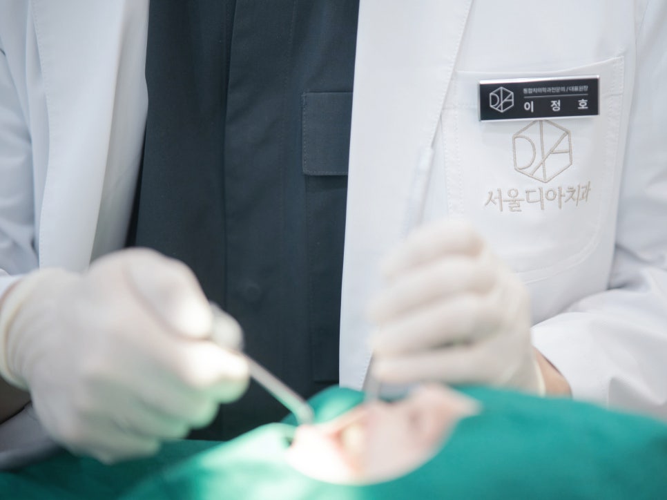 마곡치과_ 2. 이갈이 장치 사용 후기와 적응법 관련 이미지 6