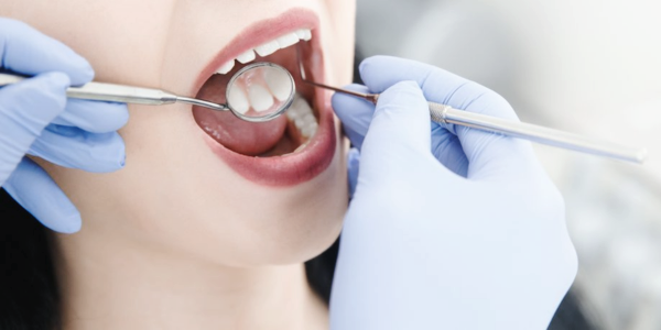 마곡동치과_4. 치주질환 진단검사로 잇몸병 진행 정도 바로 확인하세요! 관련 이미지 1