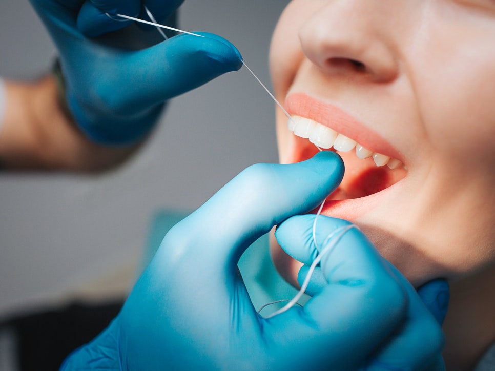 마곡동치과_3. 치실은 꼭 해야 할까요? 치아 사이 관리가 중요한 진짜 이유 관련 이미지 1