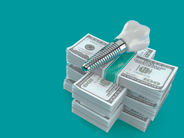 Magok Dental Clinic_ 5. A Complete Guide to Full-Mouth Implant Prices: How Much Will I Actually Pay? image 5