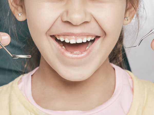 마곡역치과_&ldquo;불소도 다 똑같지 않아요!&rdquo;[2. 불소 종류와 상황별 선택법] 관련 이미지 9