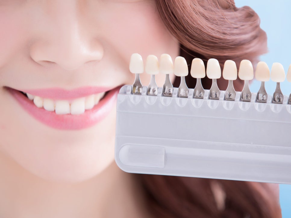 마곡역치과_ 하얀 치아로 가는 가장 빠른 길! [ 3. 생활치 전문가 미백의 특징과 과정 ] 관련 이미지 2