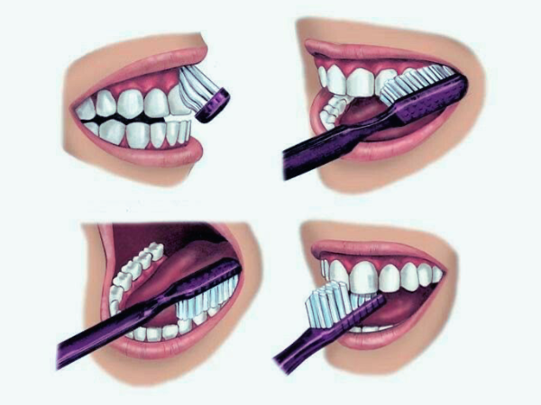 마곡역치과_"미리 막으면 더 쉽다!&rdquo;[3. 치수염 예방] 관련 이미지 1