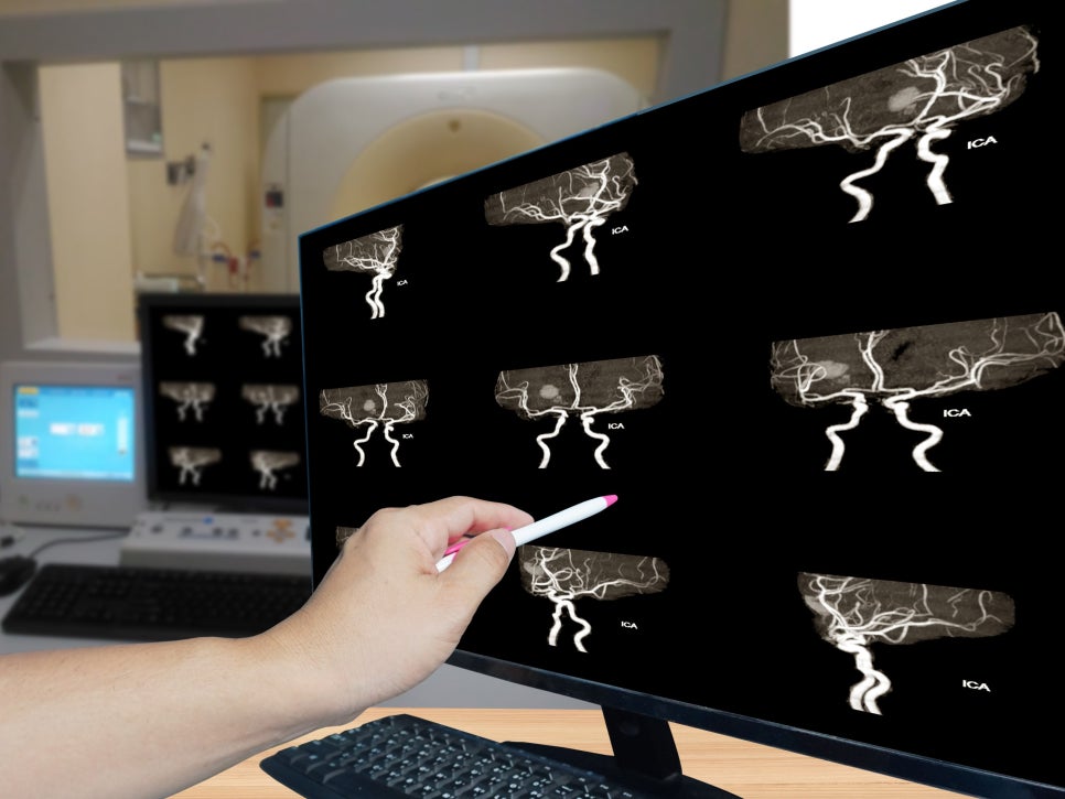 마곡치과_2. 임플란트 수술 전 전신질환별 주의 체크 포인트 관련 이미지 6