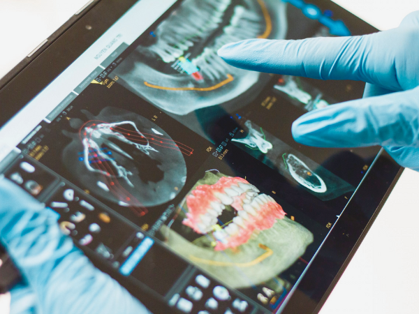 마곡동치과_&ldquo;왜 가격이 다를까?&rdquo;[4. 3D 네비게이션 임플란트 비용과 보험 그리고 선택기준] 관련 이미지 7