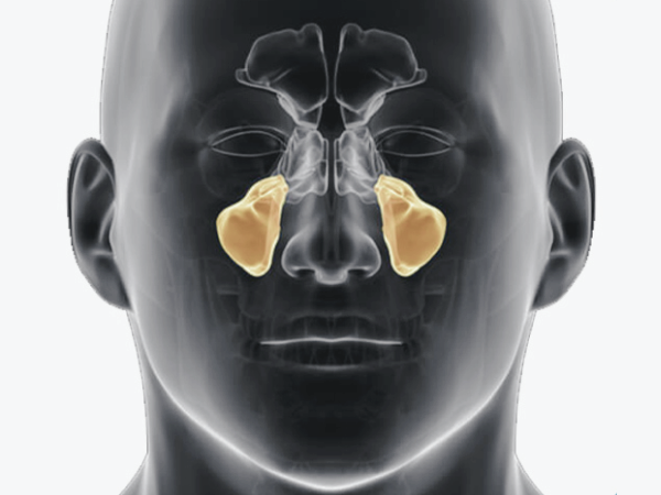 마곡역치과_1. 상악동거상술이란? 위턱 임플란트 전 꼭 알아야 할 정의와 적응증 관련 이미지 1