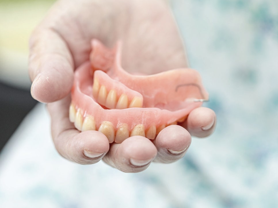 마곡동치과_1. 임플란트 치료에 관련 이미지 4