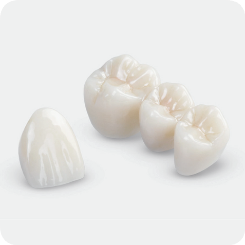 마곡역치과_잃어버린 치아, 그 자리에 다시 &lsquo;내 것 같은&rsquo; 이를! [ 1. 임플란트 기본 구조 ] 관련 이미지 4