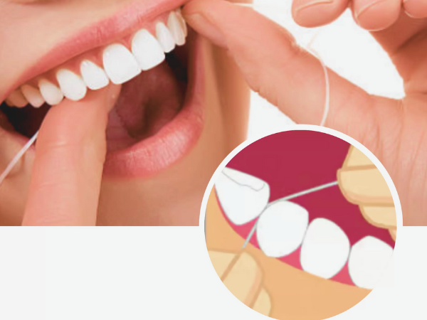 마곡동치과_3. 양치 열심히 하는데 음식이 낀다면? 치간칫솔이 필요한 신호일 수 있습니다 관련 이미지 2