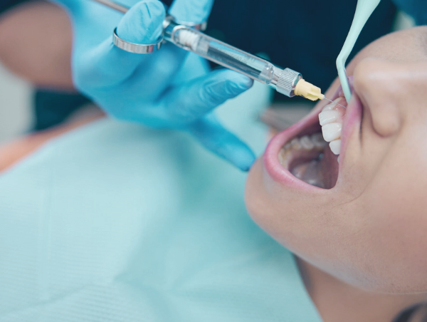 마곡역치과_3. 치아 보호를 위한 크라운 보철 치료 과정 관련 이미지 2