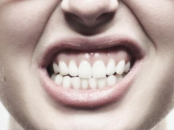 마곡역치과_5. 크라운 보철물 손상과 탈락, 원인과 치료 관련 이미지 2