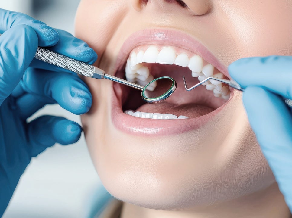 마곡역치과_5. 브릿지 치료 후 관리 방법, 오래 쓰기 위해 꼭 챙겨야 할 것들 관련 이미지 5