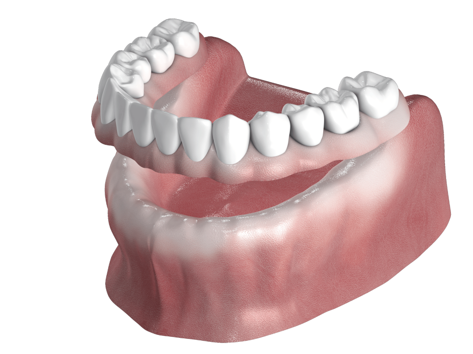 [ 마곡동치과_치아상실 5 ] 틀니, 실제로 써보면 어떤 느낌일까요? 관련 이미지 4