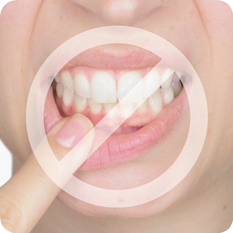 마곡역치과_ 6. 치주질환 치료 후 주의사항 정리, 잇몸 회복을 위한 똑똑한 습관 관련 이미지 7