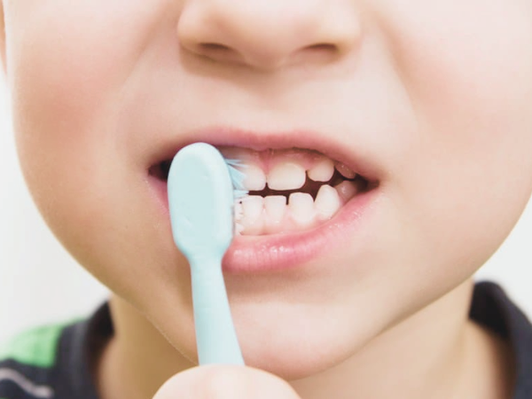 마곡역치과_2. 유치기 어린이(4~7세) 충치 예방, 부모가 꼭 알아야 할 구강 관리법 관련 이미지 4