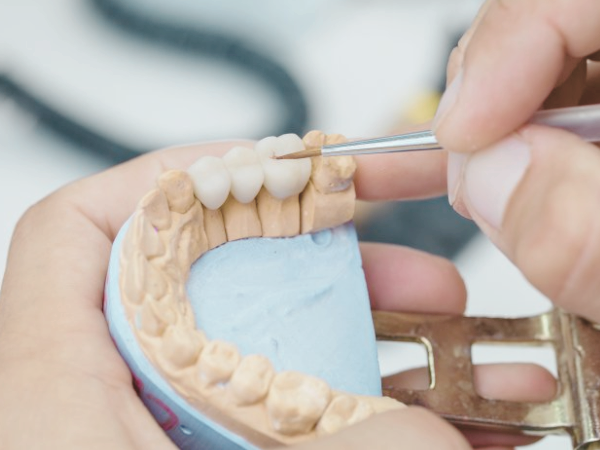 마곡역치과_5. 크라운 보철물 손상과 탈락, 원인과 치료 관련 이미지 4