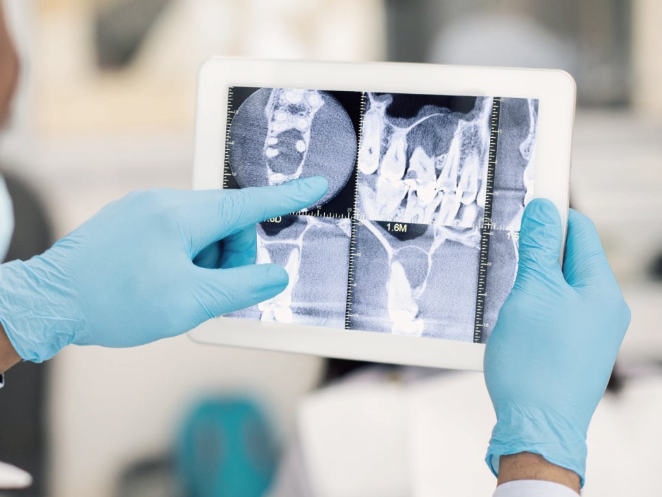 Maguok Station Dental Clinic_3. Do I Really Need Dental X-rays? The Real Problems Visible Only Through Radiographic Exams image 2