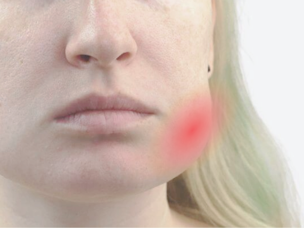 마곡동치과_&ldquo;이건 단순한 붓기가 아닙니다!" [ 2. 잇몸 고름 주머니 증상 ] 관련 이미지 5