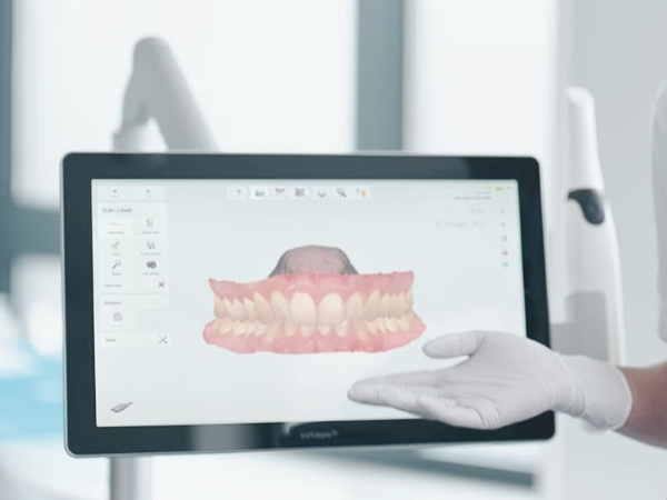 Magok-dong Dental Clinic_ “Taking Dental Impressions with Light!” [5. Digital Impression Taking with a 3D Intraoral Scanner] image 4