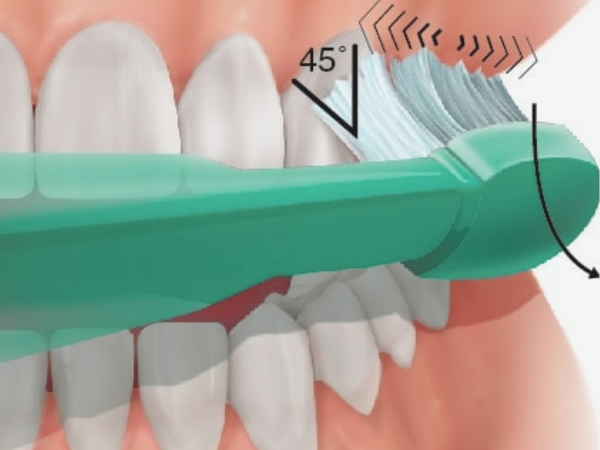 마곡동치과_ 2. 올바른 양치법이란? [하루 3번보다 중요한 방향과 위치 그리고 힘의 기준] 관련 이미지 3
