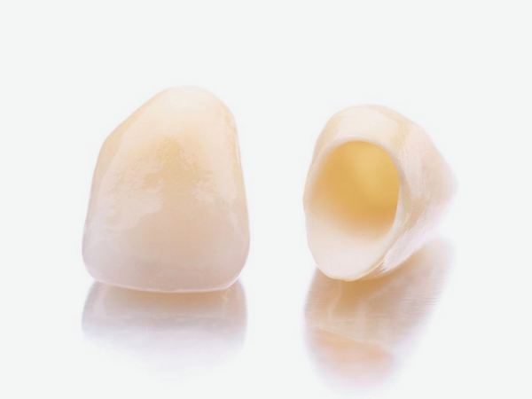 마곡동치과_2. 치과 크라운 보철의 종류별 장단점과 비용 관련 이미지 3