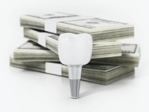 마곡동치과_ &ldquo;내게 꼭 맞는 선택일까?&rdquo; [ 2. 임플란트 틀니가 필요한 경우 ] 관련 이미지 5