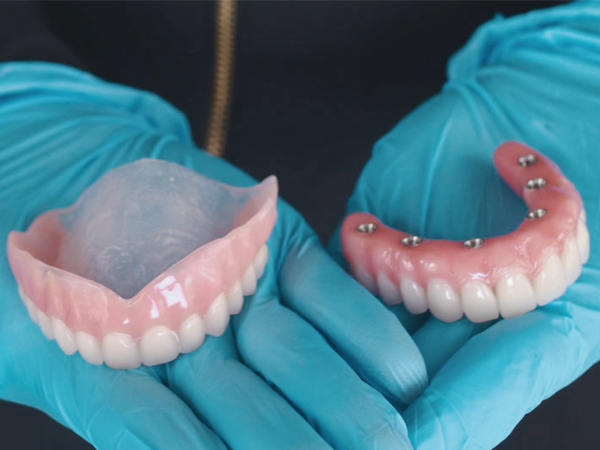 Magok Station Dental Clinic_“What Is Right for Me?” [2. A Complete Guide to Denture Types] image 4