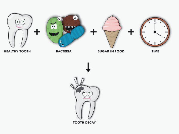마곡동치과_&ldquo;불소, 치아를 어떻게 지켜주는 걸까?&rdquo;[1. 불소의 원리와 작용] 관련 이미지 3