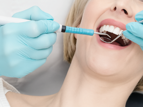 마곡역치과_ 하얀 치아 오래 가는 6가지 관리 루틴 [ 6. 치아 미백 후 주의사항 ] 관련 이미지 6