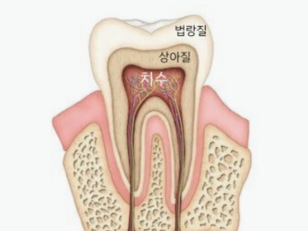 마곡역치과_3. 밤에 치통이 심해지는 이유? 치수염 통증 특징 관련 이미지 1