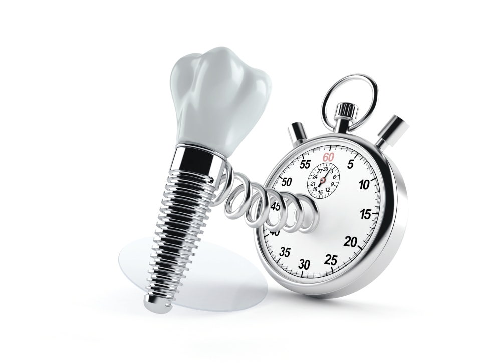 마곡치과_1. 임플란트 수술 전 꼭 짚고 가야 할 기준 5가지 관련 이미지 5