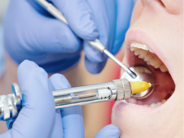 마곡동치과_2. 치과 마취는 언제 풀릴까요?국소마취 후 꼭 알아야 할 주의사항 관련 이미지 1