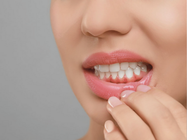Magok Dental Clinic_5. Is Discomfort After Gum Treatment Normal? A Guide to Pain and Eating Care image 2