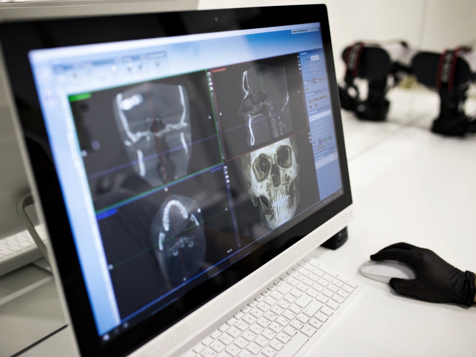 [ 마곡동치과_치아 상실 2 ] 치아 빠졌을 때 치료, 지금 해야 할까요? 미루면 더 복잡해집니다 관련 이미지 3