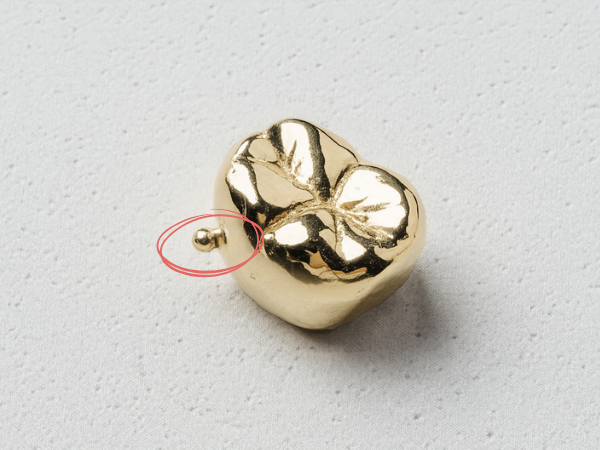 마곡역치과_ "보철물 씌웠다고 끝? 진짜 관리는 지금부터!" [ 4. 신경치료 후 크라운 관리법 ] 관련 이미지 3