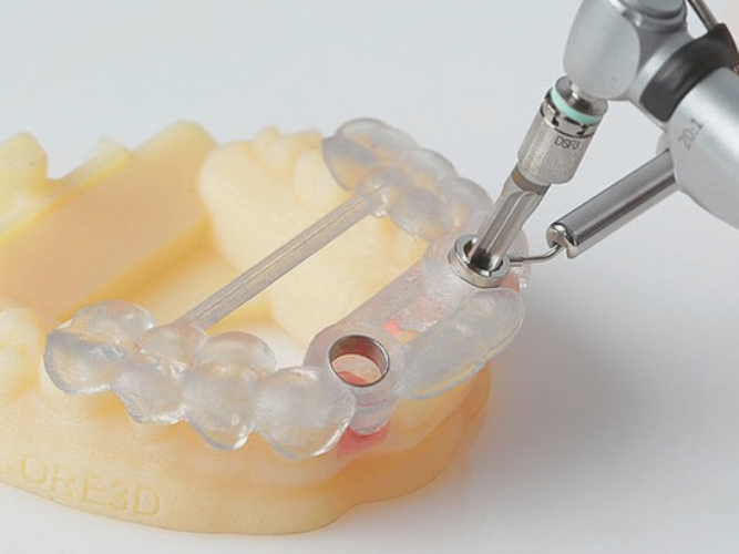 마곡치과_"CT 분석부터 가이드 제작까지!"[2. 3D 네비게이션 임플란트 진행과정] 관련 이미지 3